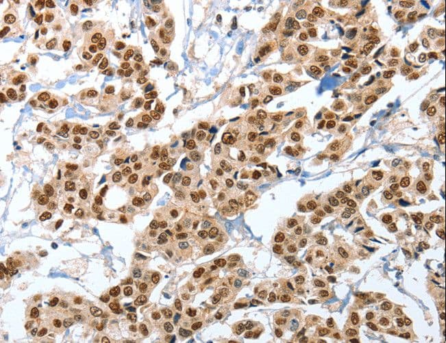Polyclonal Rabbit anti-Human ANXA10 / Annexin A10 Antibody (IHC)