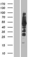 CTMP / THEM4 Protein (Over-Expression Lysate Myc-DDK (Flag))