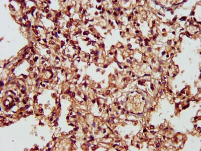 Polyclonal Rabbit anti-Human CHST11 Antibody (IHC)