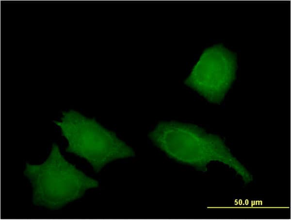 IREB2 / IRP2 Antibody (clone 1F3)