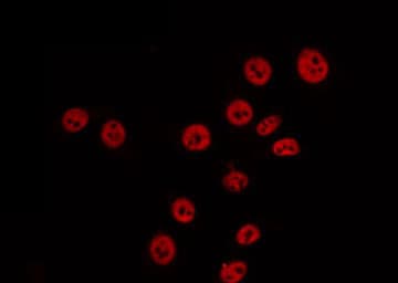 ABCA6 Antibody