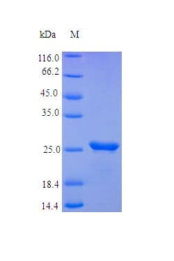 Human FGF23 Protein (Recombinant)