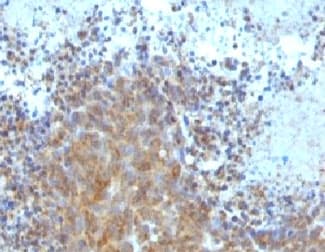 BAX Antibody (clone BAX/962)