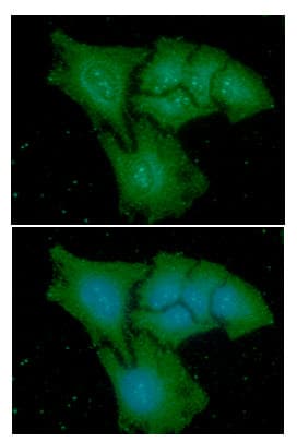Monoclonal Mouse anti-Human CAPG Antibody (clone AT1D10, WB)