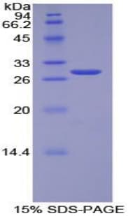 Human TOR1AIP2 Protein (Recombinant His-T7)