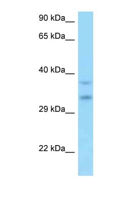 MSANTD3 Antibody (aa101-150)