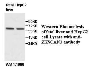 ZKSCAN3 / ZNF306 Antibody (aa175-440)