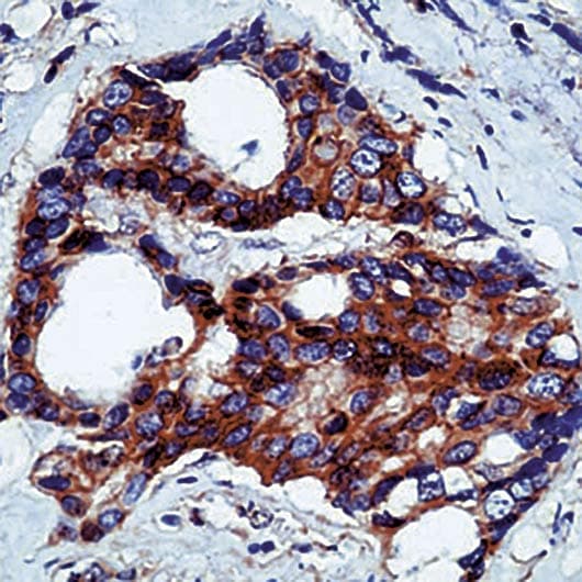 CTNNB1 / Beta Catenin Antibody (C-Terminus)