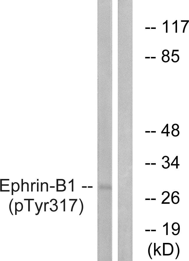 Polyclonal Rabbit anti-Human EFNB1 / Ephrin B1 Antibody (phospho-Tyr317, WB)