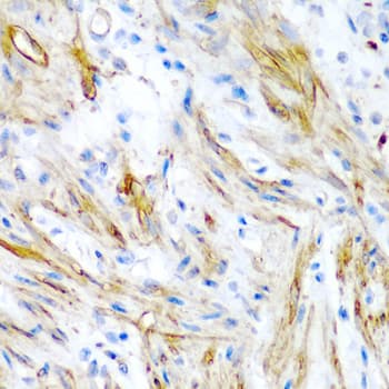 LMOD1 Antibody