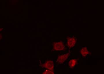 NBN / Nibrin Antibody