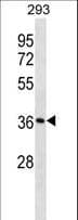 Polyclonal Rabbit anti-Human SMN1 Antibody (aa262-288, WB)