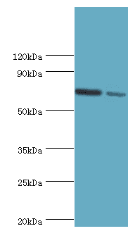 Polyclonal Rabbit anti-Human APLP1 / APLP-1 Antibody (aa39-300, WB)