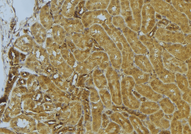 Polyclonal Rabbit anti-Human CKAP4 Antibody (IHC, IF, WB)
