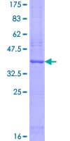 Human OSTC Protein (Recombinant GST)