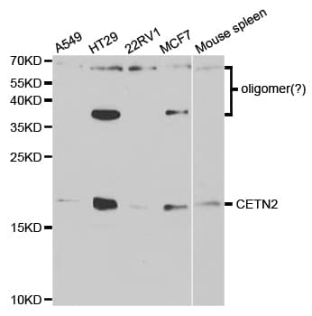 CETN2 / Centrin 2 Antibody
