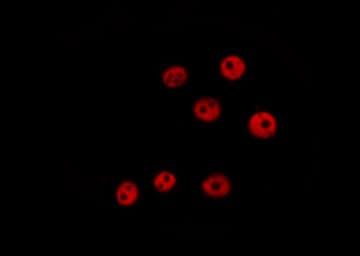 KHSRP / FBP2 Antibody