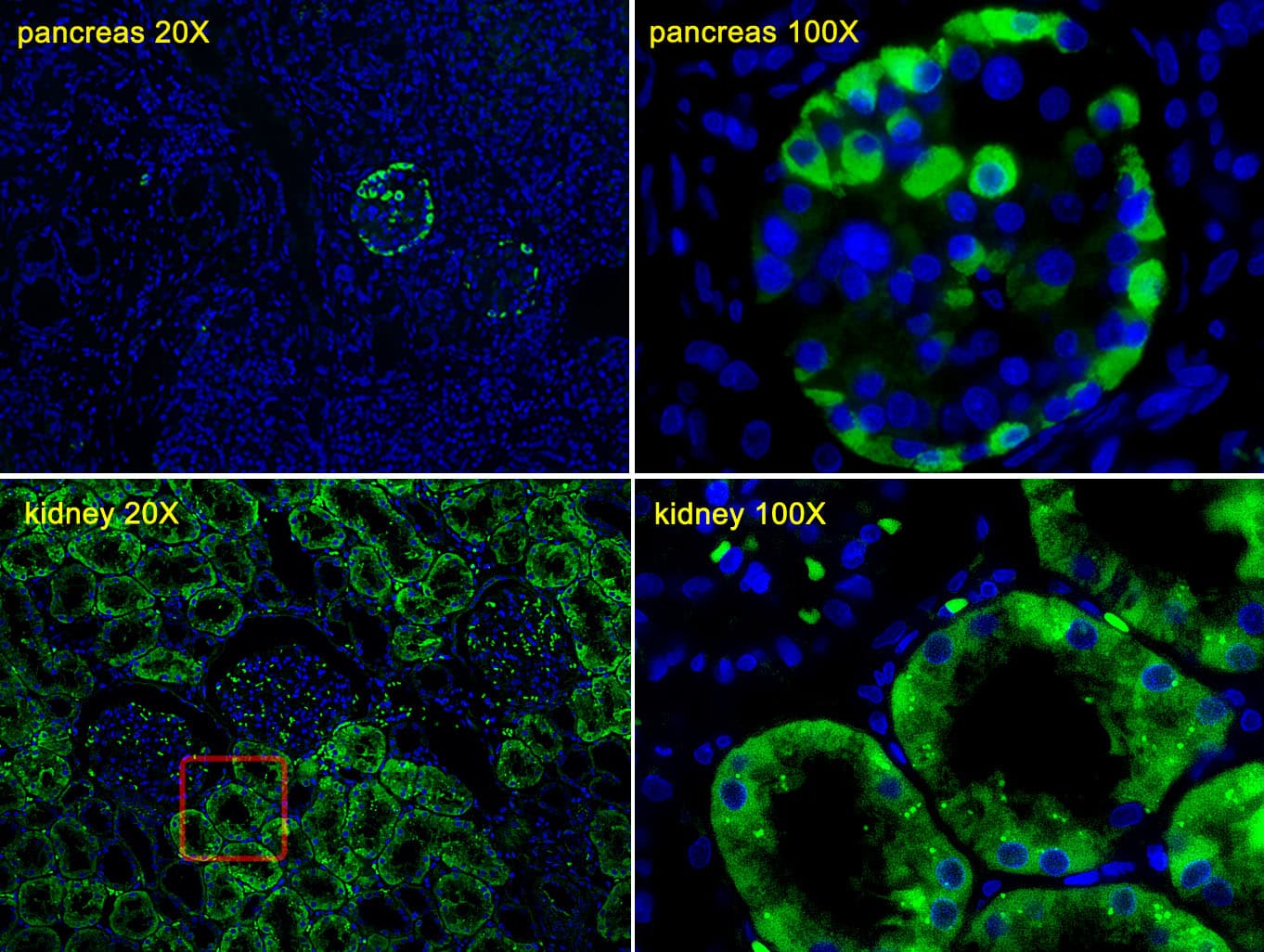 TTR / Transthyretin Antibody (aa71-98)
