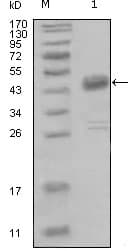 IHC-plus™ NEP / DDR1 Antibody (clone 2G4E12)