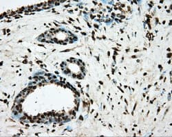 Monoclonal Mouse anti-Human Basigin / Emmprin / CD147 Antibody (clone OTI4E11, IHC, IF, WB)