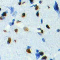 Polyclonal Rabbit anti-Human TCFL5 Antibody (C-Terminus, IHC, WB)