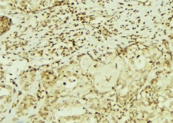 CEMIP / KIAA1199 Antibody