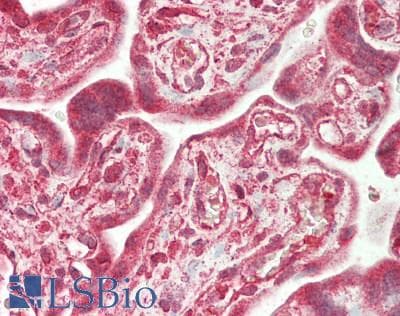 IHC-plus™ NMT2 Antibody (aa100-150)