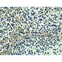 TNFRSF10A / DR4 Antibody