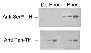PathPlus™ TH / Tyrosine Hydroxylase Antibody (phospho-Ser40)