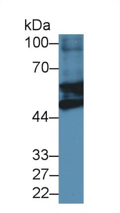 GFAP Antibody (aa70-374, FITC)