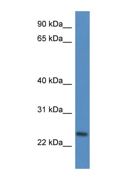 CD9 Antibody (N-Terminus)