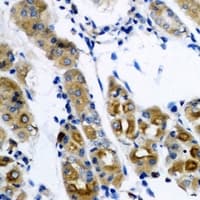 SARS / Serine-tRNA Ligase Antibody