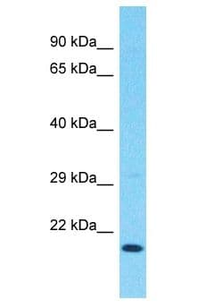 REEP6 Antibody (aa135-184)