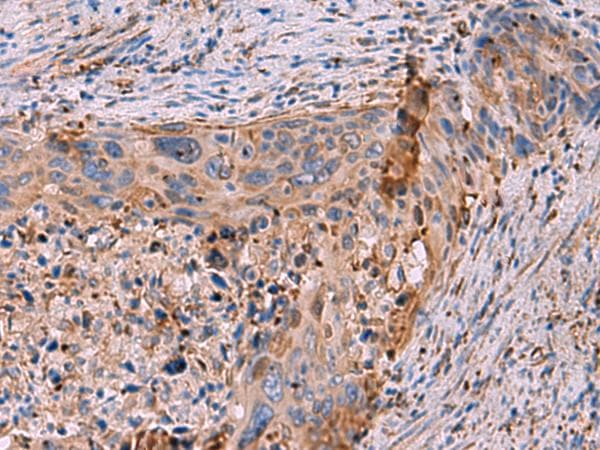 Polyclonal Rabbit anti-Human KBTBD11 Antibody (IHC)
