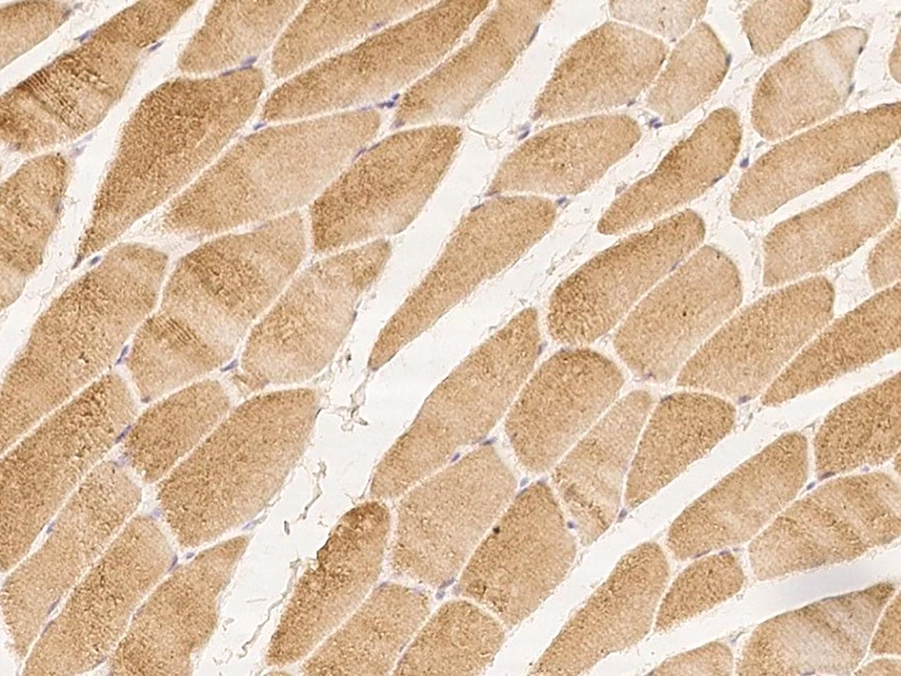 C5orf22 Antibody