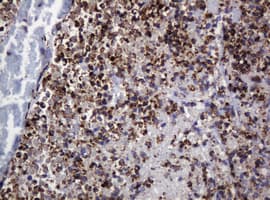 Monoclonal Mouse anti-Human POGK Antibody (clone OTI3E2, IHC, WB)