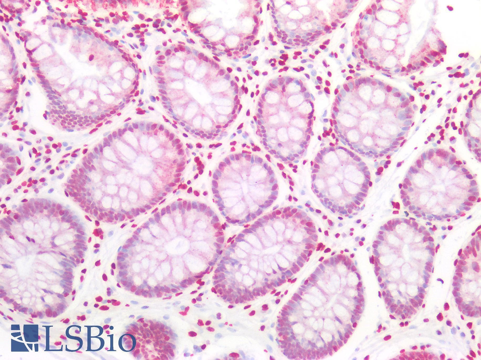 PathPlus™ H2AFX / H2AX Antibody