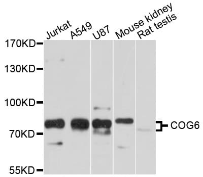 Polyclonal Rabbit anti-Human COG6 Antibody (WB)
