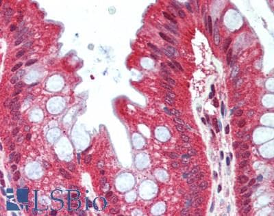 VIPERIN / RSAD2 Antibody (aa42-361)