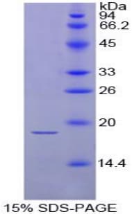 Chicken TSHB / TSH-Beta Protein (Recombinant His, N-Terminal)
