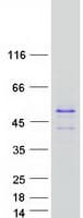 Human TSPY3 Protein (Recombinant Myc-DDK (Flag))