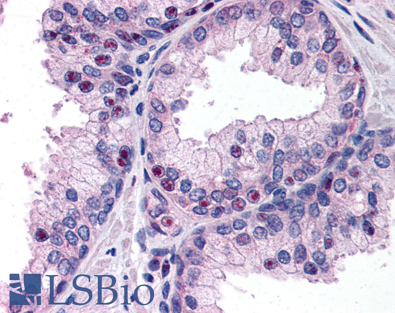 IHC-plus™ SIP / TP53INP1 Antibody