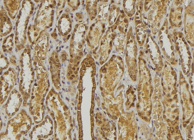 Polyclonal Rabbit anti-Human CXCL3 / GRO Gamma Antibody (IHC, WB)