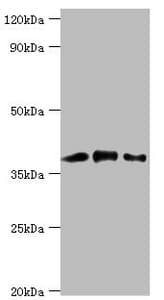 Polyclonal Rabbit anti-Human CAPG Antibody (aa1-348, WB)