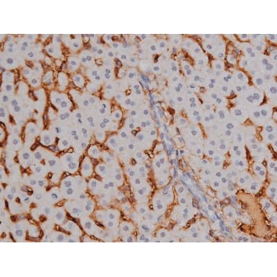 NPM1 / NPM / Nucleophosmin Antibody (phospho-Thr199)