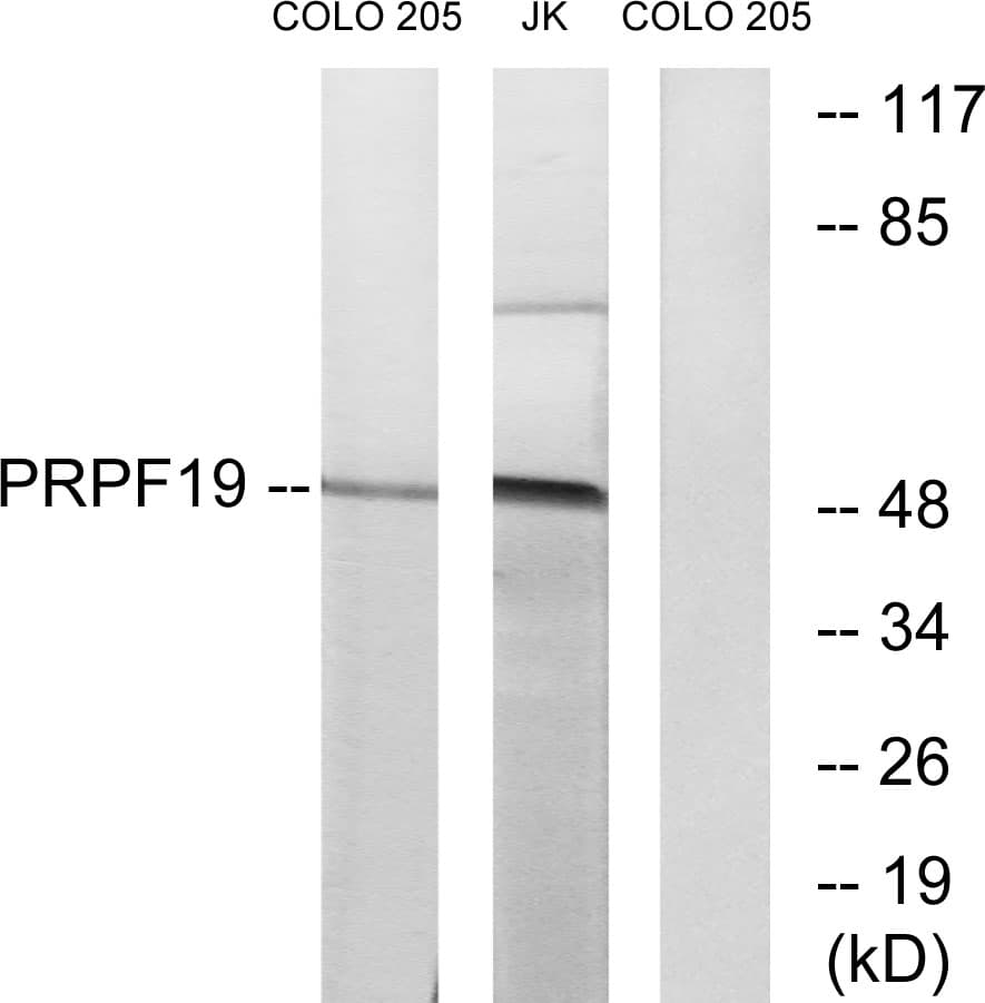 IHC-plus™ PRPF19 / PRP19 Antibody (aa171-220)