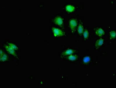 IKBKB / IKK2 / IKK Beta Antibody