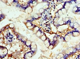 SHFM3 / FBXW4 Antibody (aa143-412)