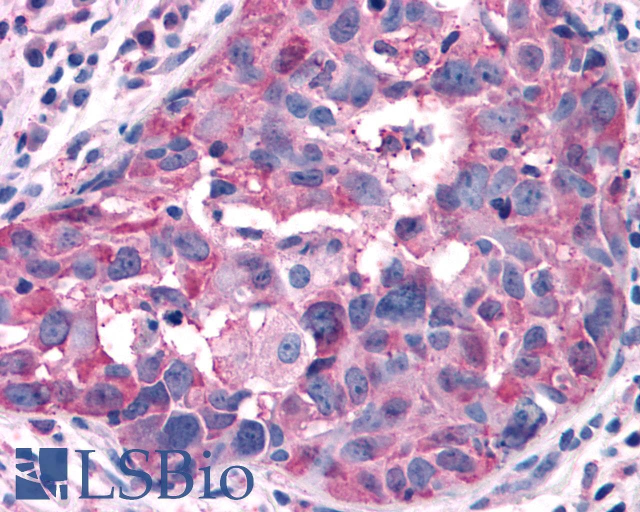 IHC-plus™ Polyclonal Rabbit anti-Human GPRC5A / RAI3 Antibody (Cytoplasmic Domain, IHC)