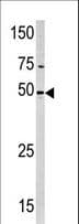 Polyclonal Rabbit anti-Human PXK Antibody (aa221-251, WB)